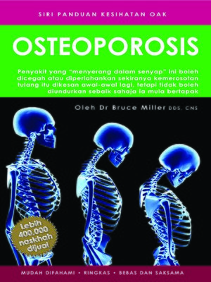 cover image of Osteoporosis(Malay)
